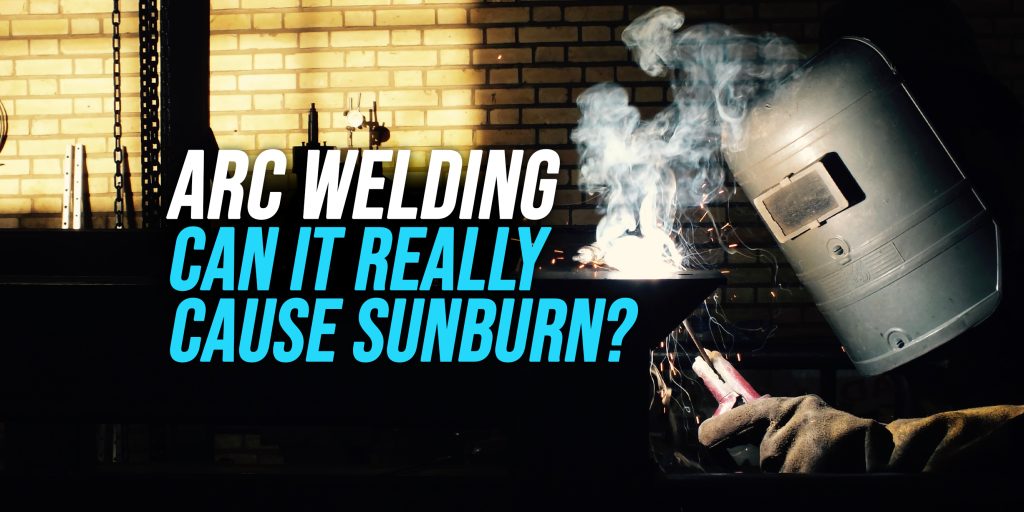 can arc welding cause sunburn